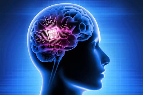 wireless brain sensor definition